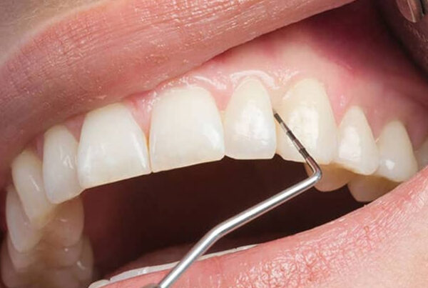 Periodontology