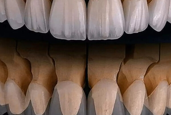 Zirconium Crowns
