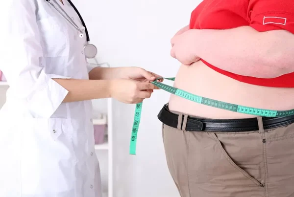 Gastric Bypass