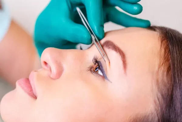 Eyelid Aesthetics