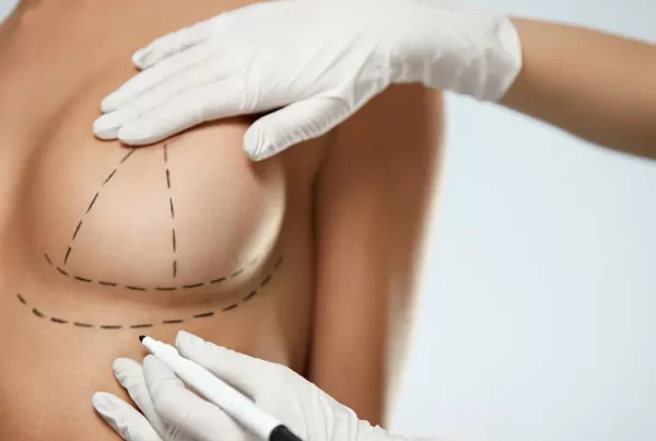Breast Lift