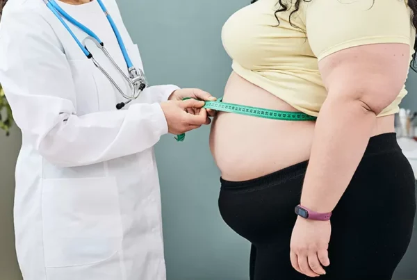 Mini Gastric Bypass