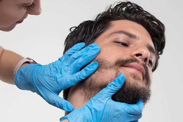 Beard Transplant