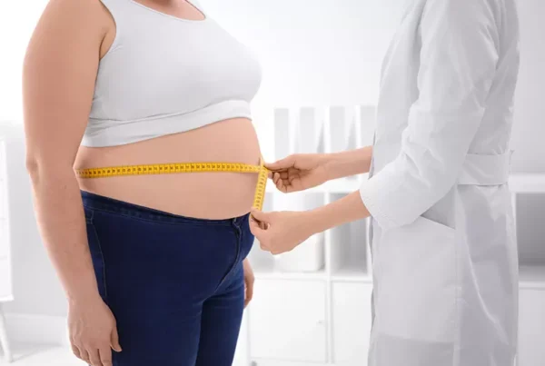 Gastric Sleeve