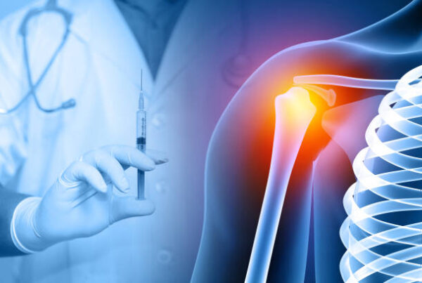 Shoulder Arthroscopy