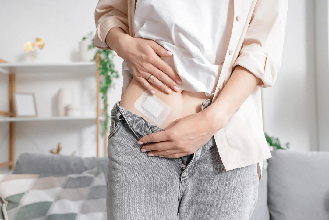 Minimally Invasive Surgery